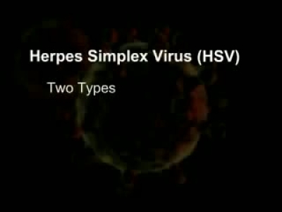 Uçuk (Herpes)